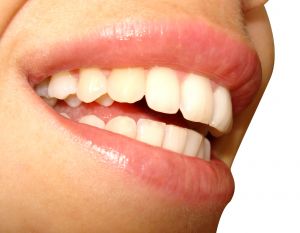 Unleash Your Smile Potential With Cosmetic Dentistry