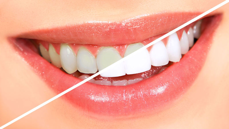 Unveil a Gorgeous Smile With the Help of the Dental Clinic in St George UT