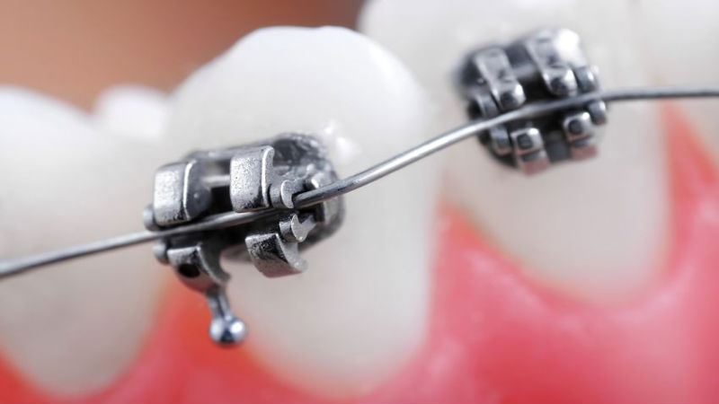 Sedation Dentistry: Why You Need It