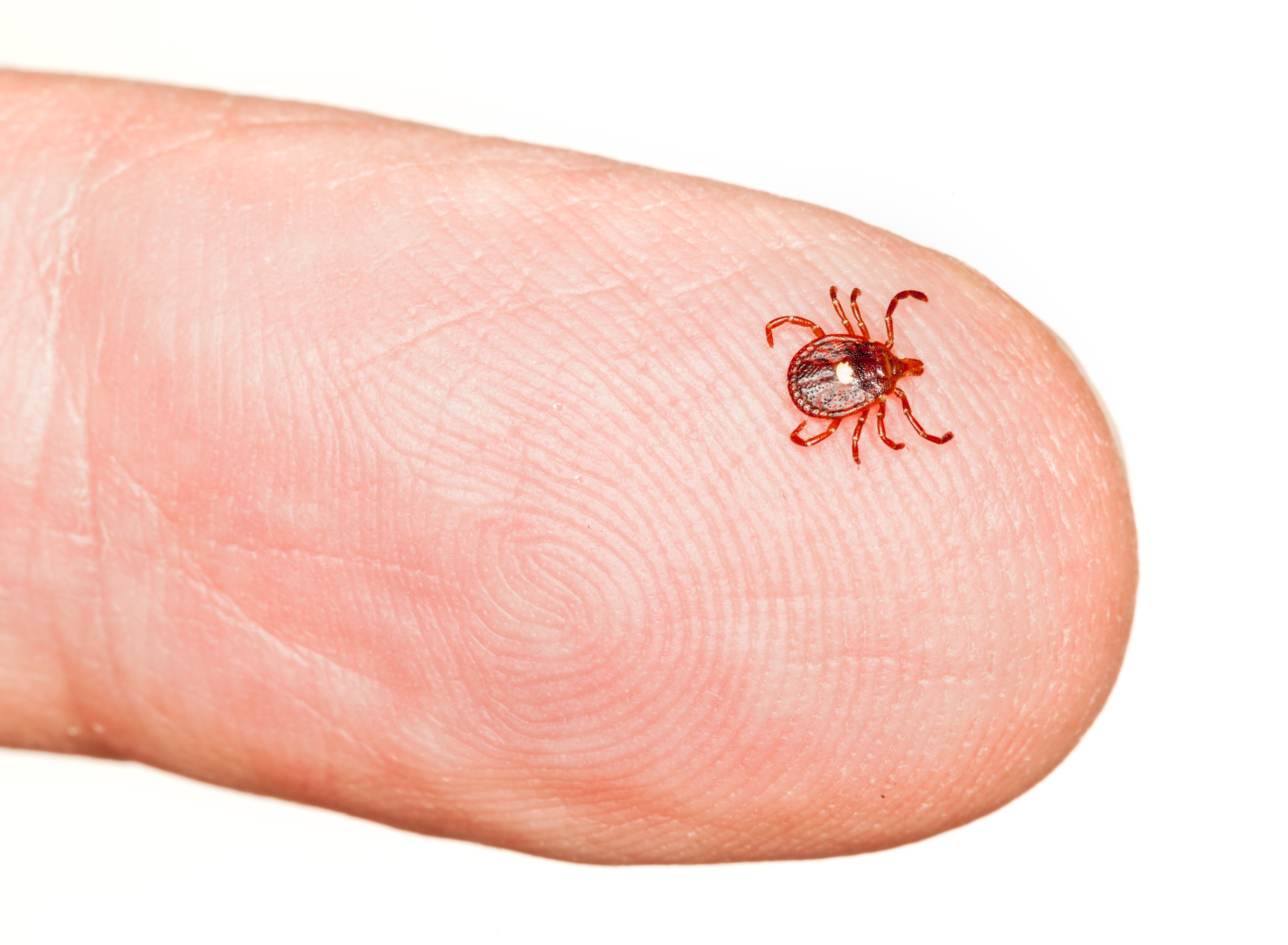 Ways To Eliminate Bed Bugs Freehold NJ