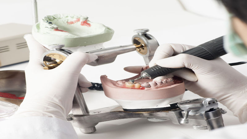 When Should One Opt For Sedation Dentistry?