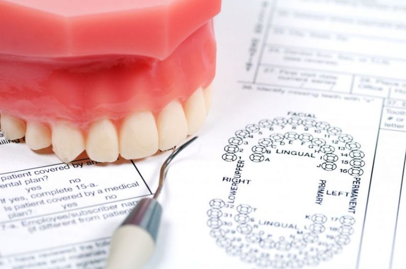 Reasons to Consider Dental Crowns in Panama City, FL