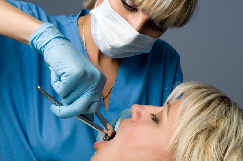 Top Five Preventative Dental Services in Mt Vernon, IA