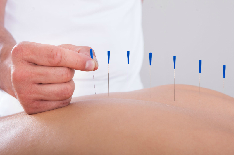 Acupuncture Offers an Alternative Way to Treat a Variety of Health Problems