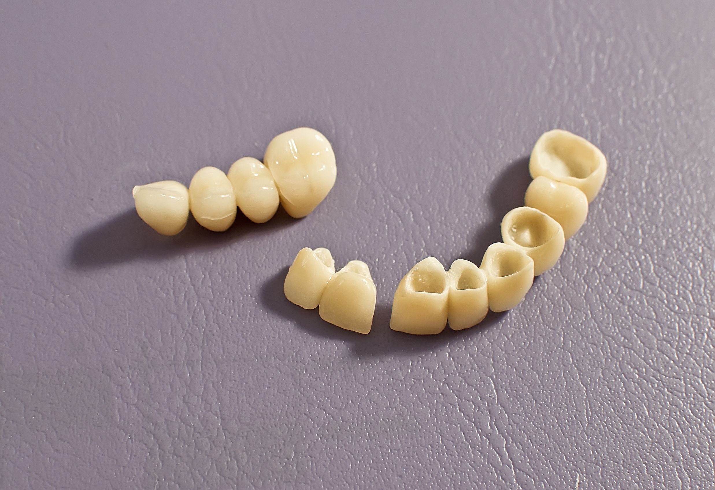 What to Expect From a Dental Bridge in Bellevue NE