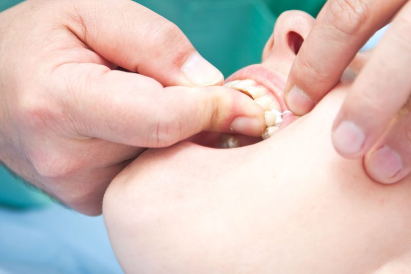 Taking a Closer Look at Modernized Porcelain Crowns in Toms River, NJ