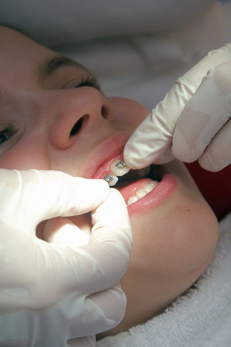 Types of Reconstructive Dentistry in Midwest City OK