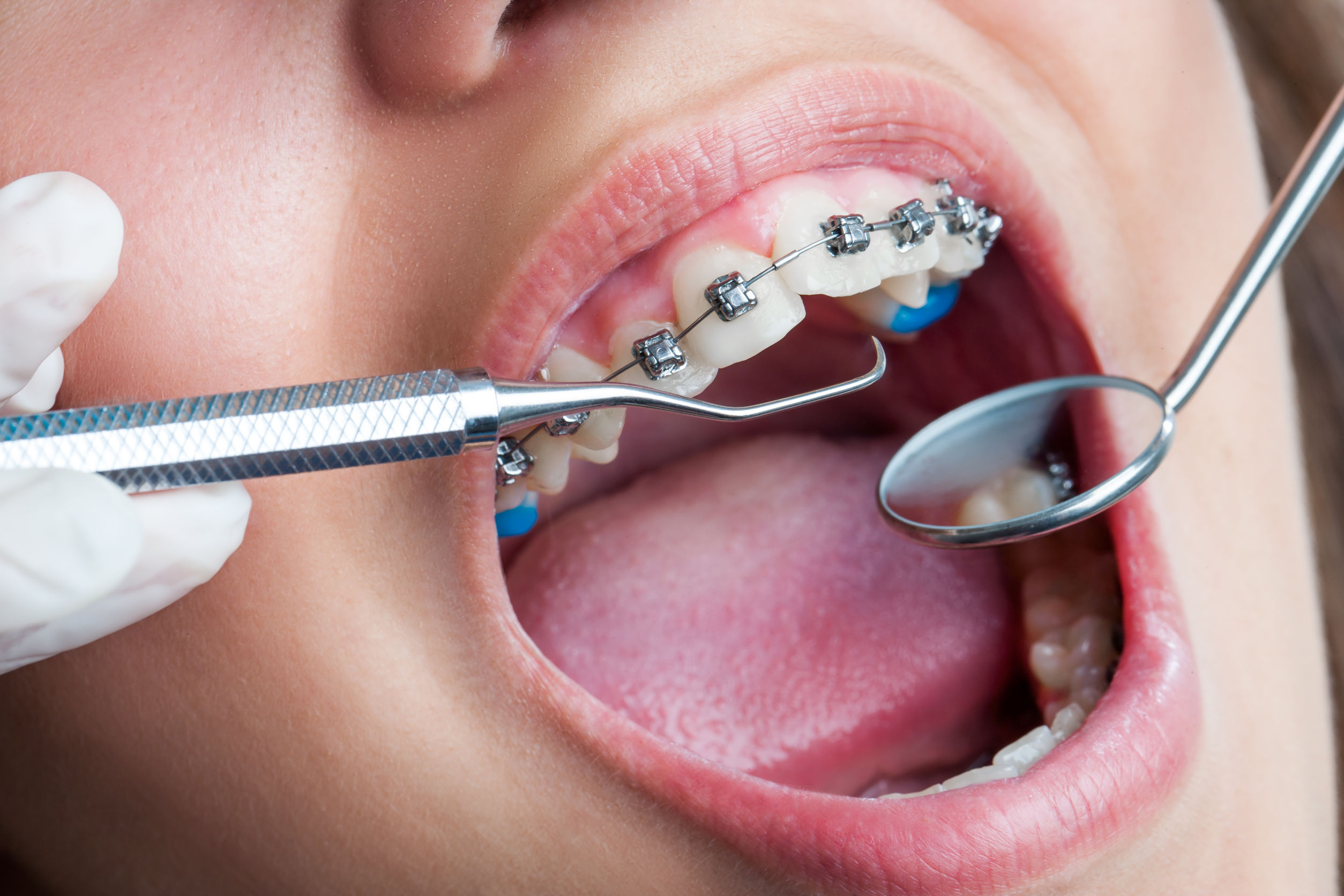 Services from a Cosmetic Dentist, Find One Near Lakeview