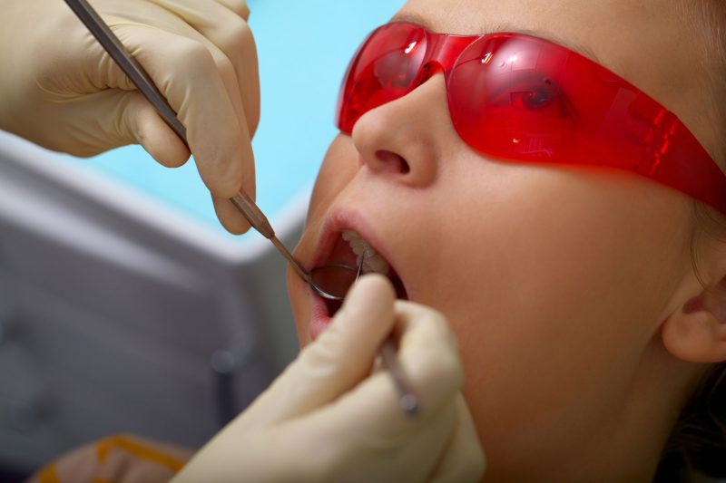 Why Get Treated with Laser Dentistry in Plainville, CT