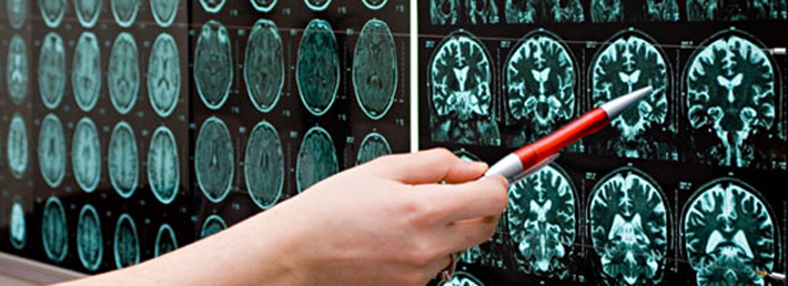 4 Things to Remember When You Pick an Imaging Facility