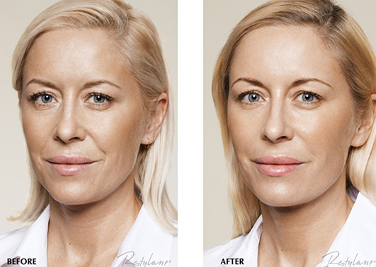 Frequently asked questions for Transgender Reassignment Surgery