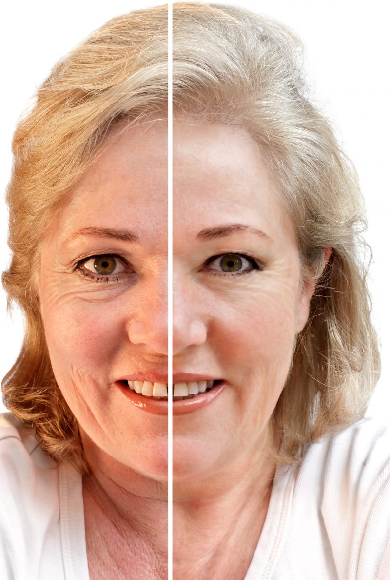 Learn More About Voluma in North Scottsdale, AZ