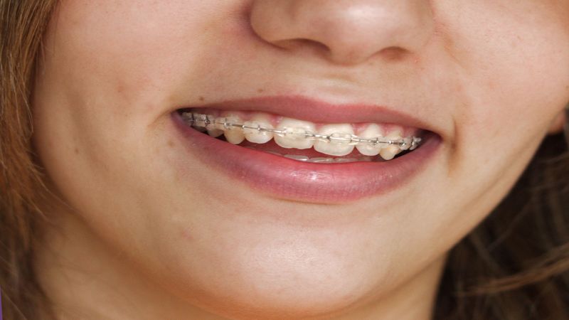 Conquer Your Fear of the Dentist with Sedation Dentistry in Florence, AZ
