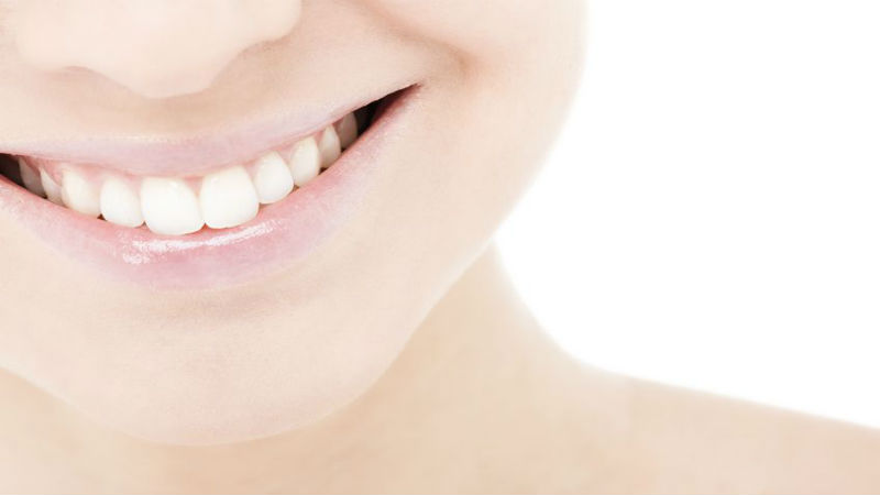 The Advantages of Undergoing Professional Teeth Whitening in Kelowna