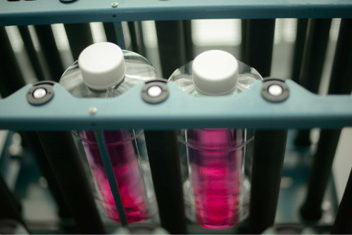 What Is Monoclonal Antibody Production?