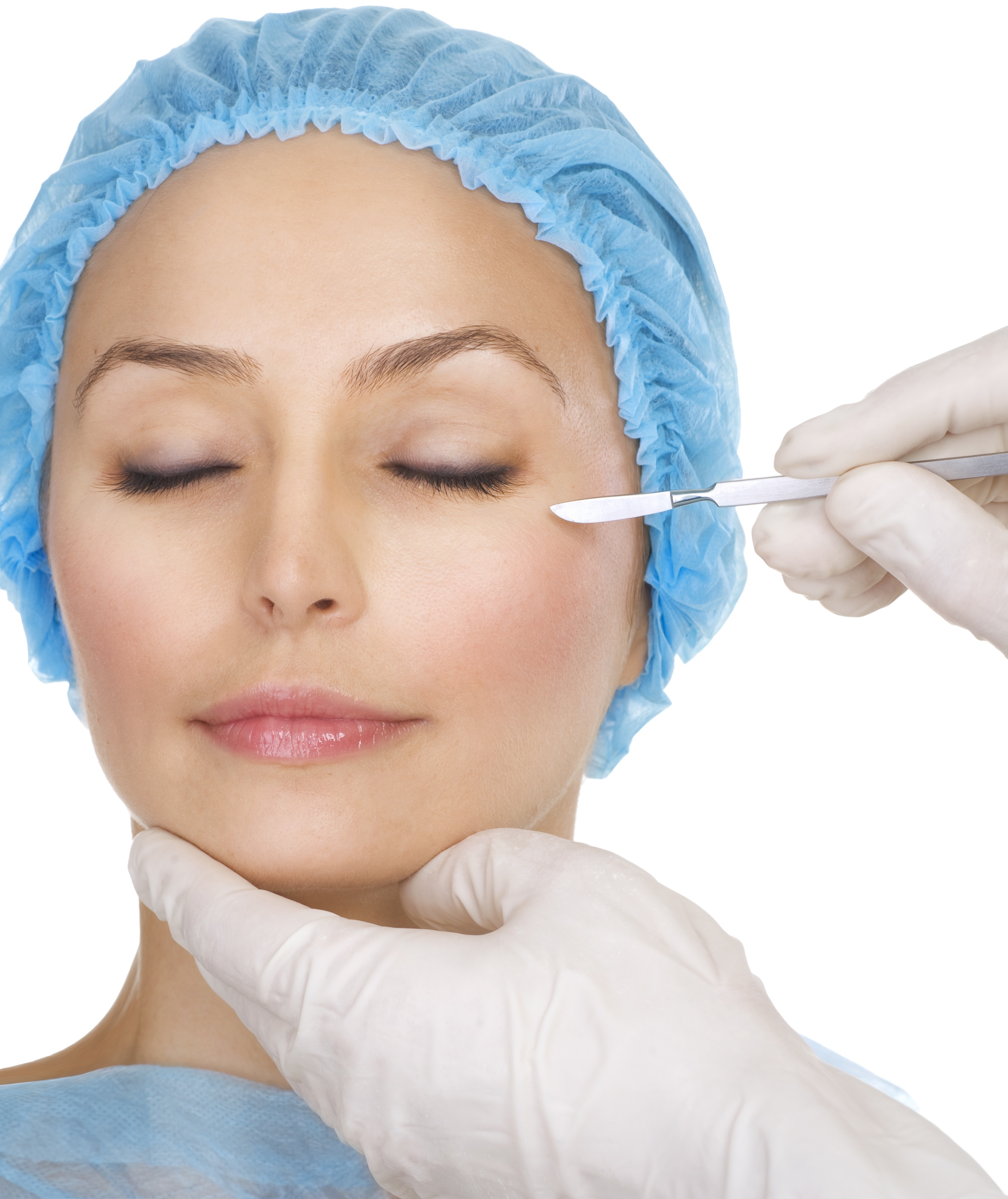 Benefits of Chemical Peels in Mississauga, ON