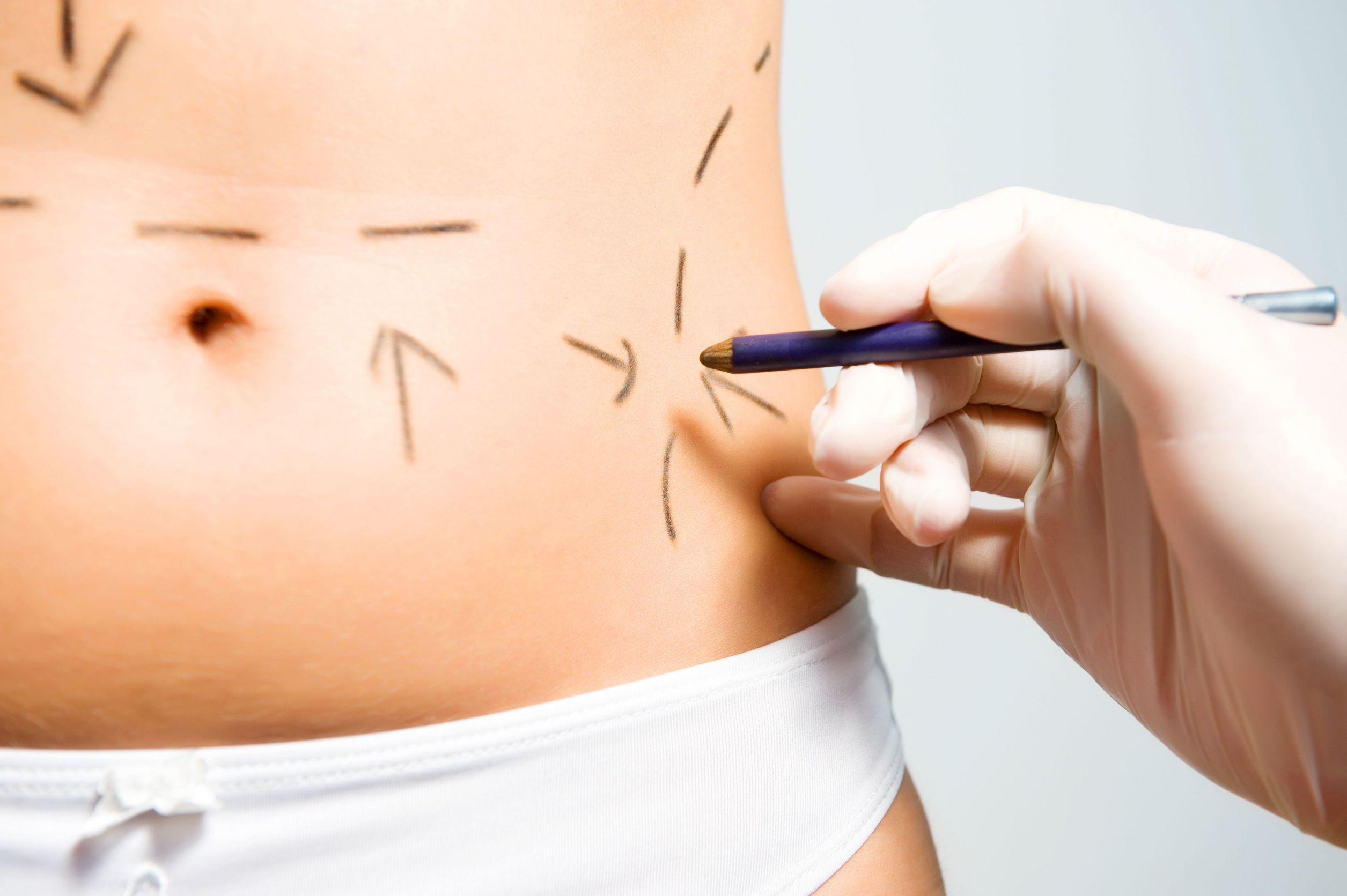 Top Things You Need to Know Before a Cosmetic Surgery in Lake Forest
