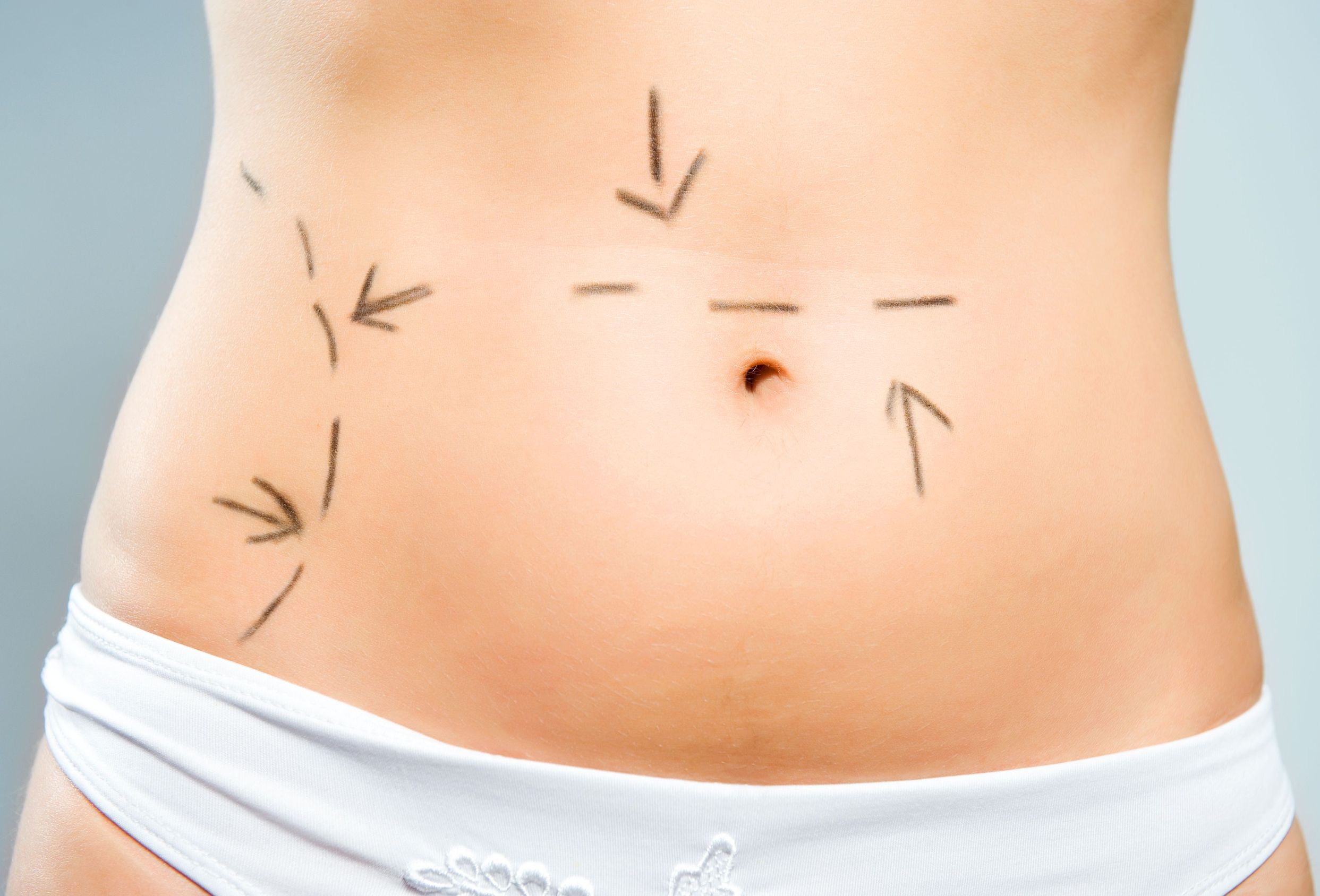 A New You: 3 Tips for Choosing a Plastic Surgeon in Illinois