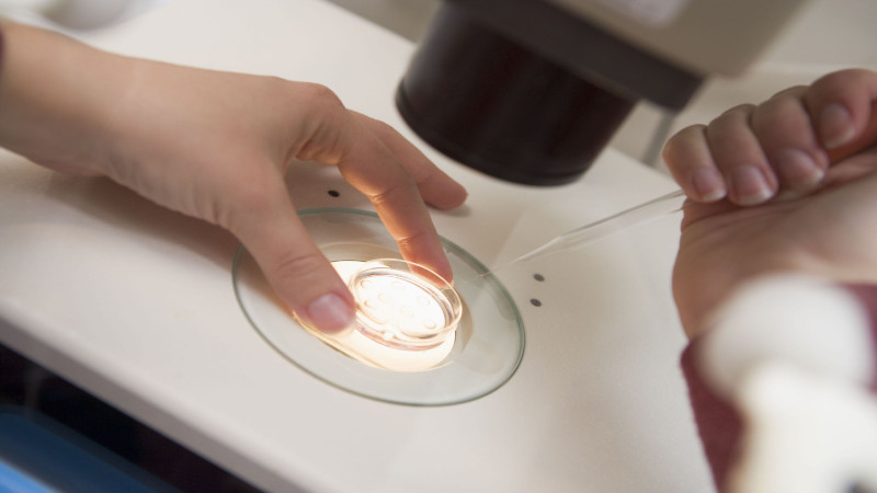 Top 3 Questions to Ask About IVF Treatment in Newport Beach, CA