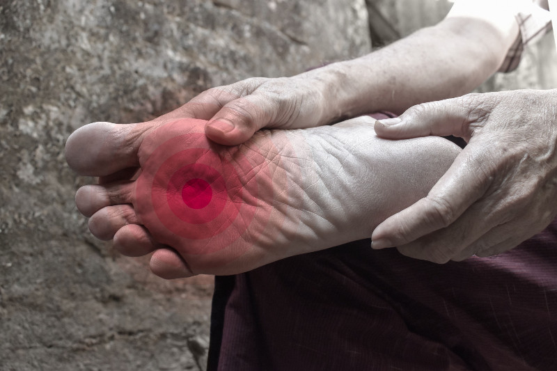 The Need for Foot Pain Treatment in Winston-Salem, NC for Plantar Fasciitis