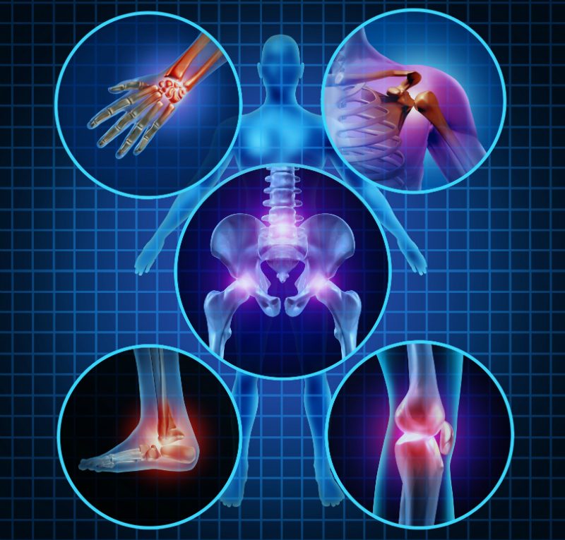 Understanding Joint Pain, Risks, and Treatment Options in Davidson, NC