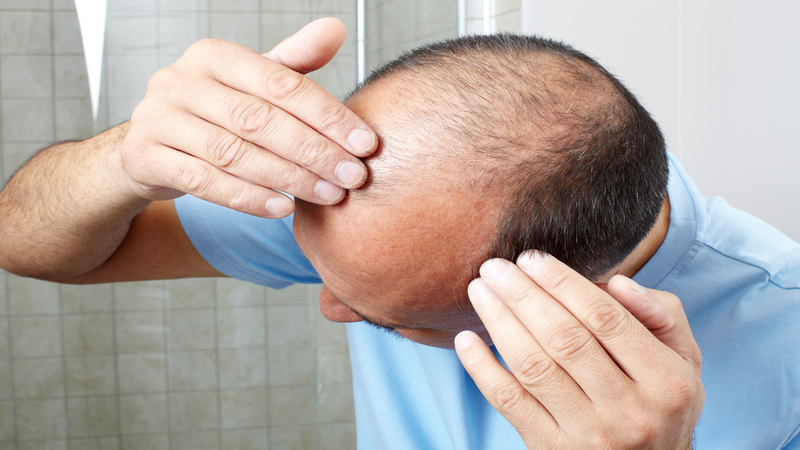 Everything You Need to Know About Hair Loss Treatment in TX