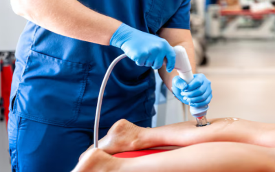 Top Benefits of Shockwave Therapy for Chronic Pain in Placentia