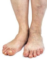Find Relief From Foot Pain With Podiatrist Services Portland Or Residents Trust